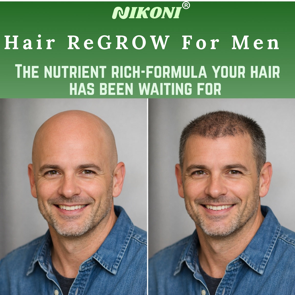 Nikoni Hair ReGROW for Men, Liposomal Hair Support Liposomal Formula with Biotin, Keratin, Saw Palmetto & Essential Nutrients-60 Vegan Softgels