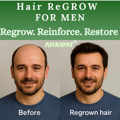Nikoni Hair ReGROW for Men, Liposomal Hair Support Liposomal Formula with Biotin, Keratin, Saw Palmetto & Essential Nutrients-60 Vegan Softgels