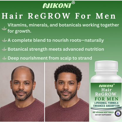 Nikoni Hair ReGROW for Men, Liposomal Hair Support Liposomal Formula with Biotin, Keratin, Saw Palmetto & Essential Nutrients-60 Vegan Softgels